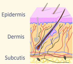 Skin Diagram Identifying Epidermis Dermis and Subcutis